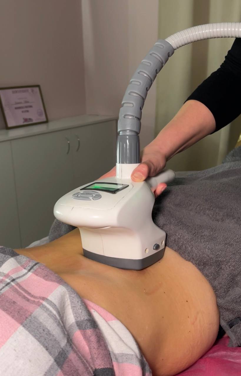 VelaShape